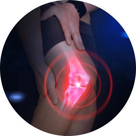 Knee Replacement Surgery